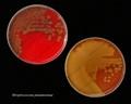 virulent and avirulent forms of Streptococcus pneumoniae, mucoid and rough form of pneumococci